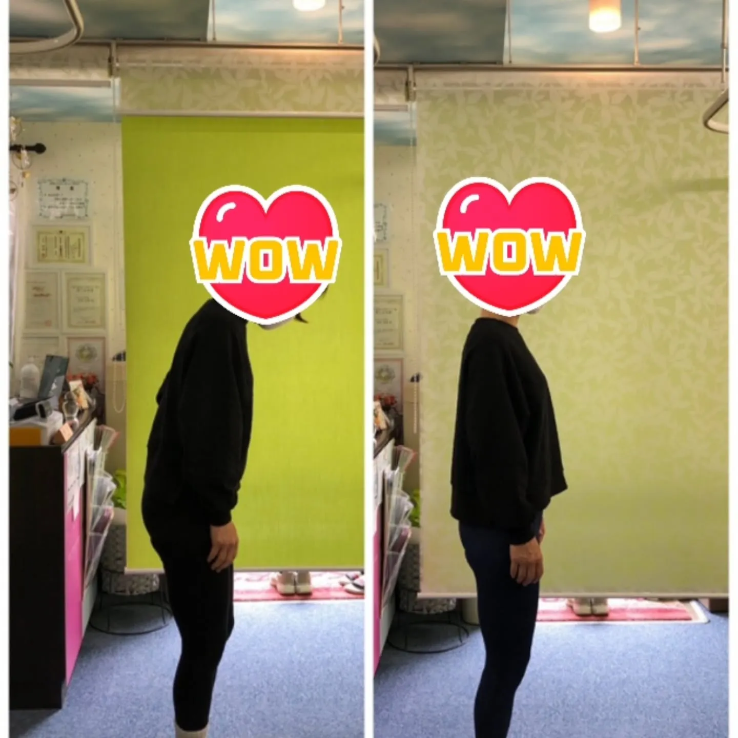 【一昨日ぎっくり腰になった患者さまが、翌日には「よくなった」...